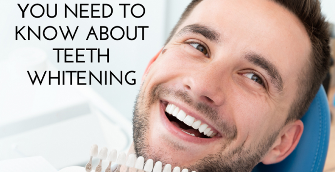 Everything You Need to Know About Teeth Whitening