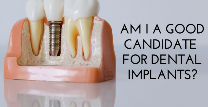 Am I A Good Candidate For Dental Implants?